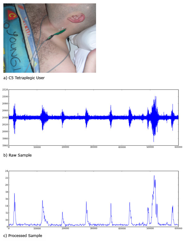 Tetraplegic person testing the system