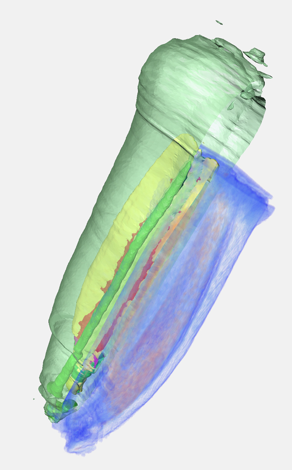 Visualization of different data modalities: NMR-based voxel intensities are displayed by volume rendering and combined with a surface view of labeled histological data.